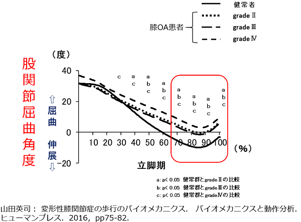 変形性膝関節症！ 立脚終期（Tst）の股関節の特徴 - 理学療法士園部