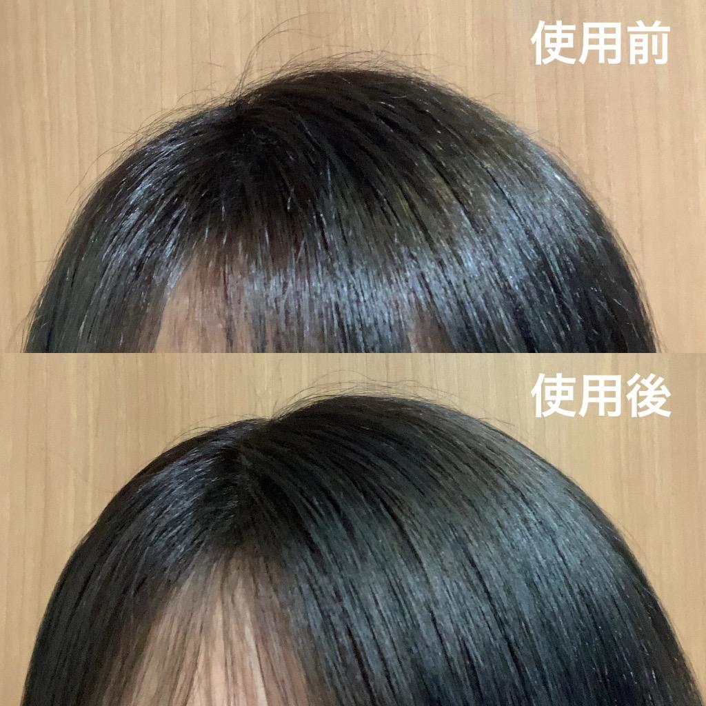 ヤクジョ 潤髪トリートメント 200g ◇BF-ROHAS-YAKUJO-TR200 送料無料