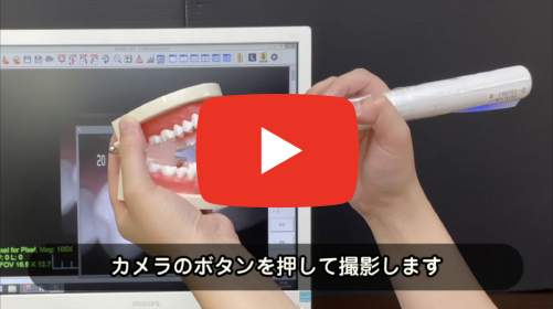 口腔内カメラ 20K｜アールエフ