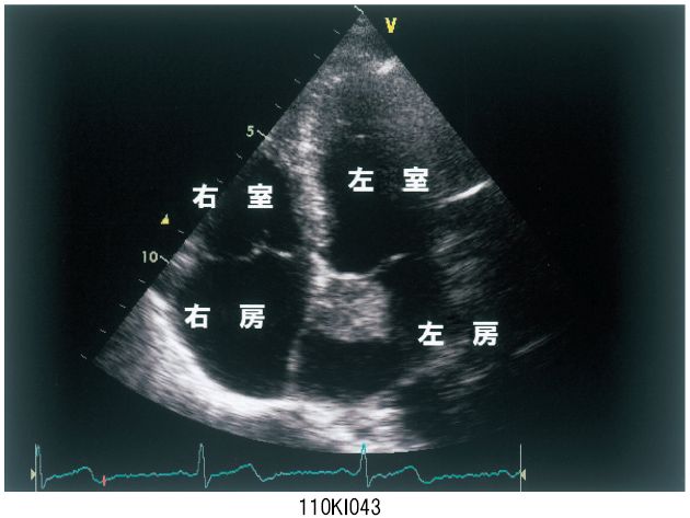 110I43 | 心臓腫瘍 国試 | テコプラ