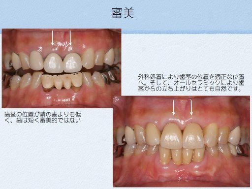 審美修復 | 医療法人 斉田歯科医院：所沢市小手指の歯医者さん