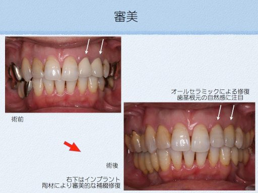 審美修復 | 医療法人 斉田歯科医院：所沢市小手指の歯医者さん