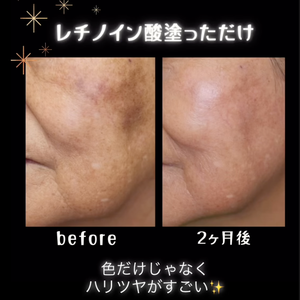ゼオスキンヘルス デイリーPD 50ml – sakuraclinic-online