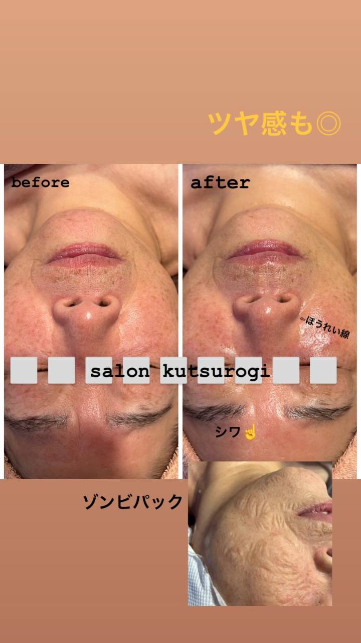 シワ 改善 ゾンビマスク | ビューティーメニューに関する様々な記事を