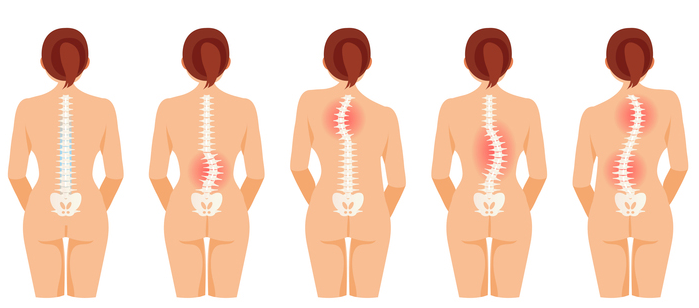 整体 爽空間|側弯症でお悩みのお客様！お任せください。