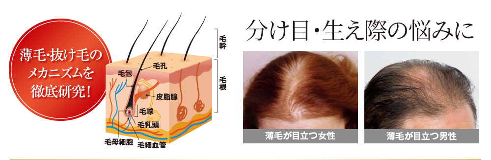 薬用育毛剤 柑気楼プレミスター さわやかタイプ 150mL 育毛 発毛 毛髪