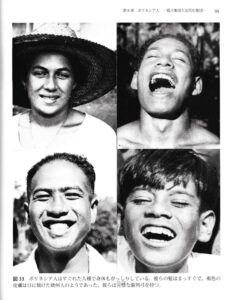 食生活と身体の退化｜しんぽ歯科医院 ｜松戸市小金原の歯医者しんぽ