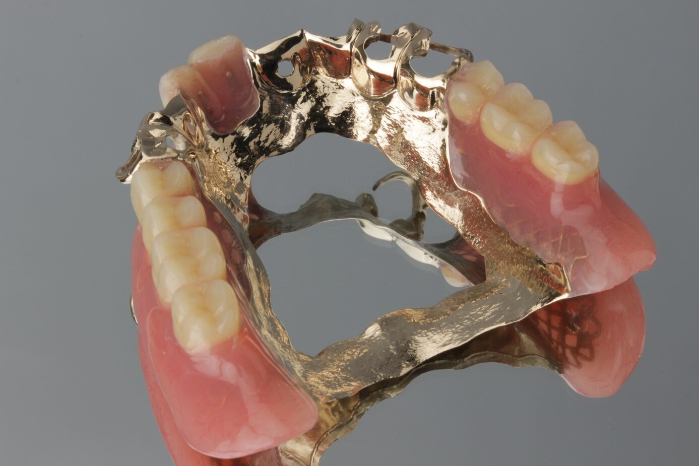 デンチャー – 歯科技工所｜株式会社シンワ歯研