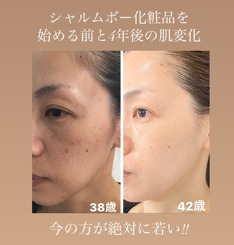 シャルムボー高額スキンケアに失敗したくない方必見！【使用後の肌変化