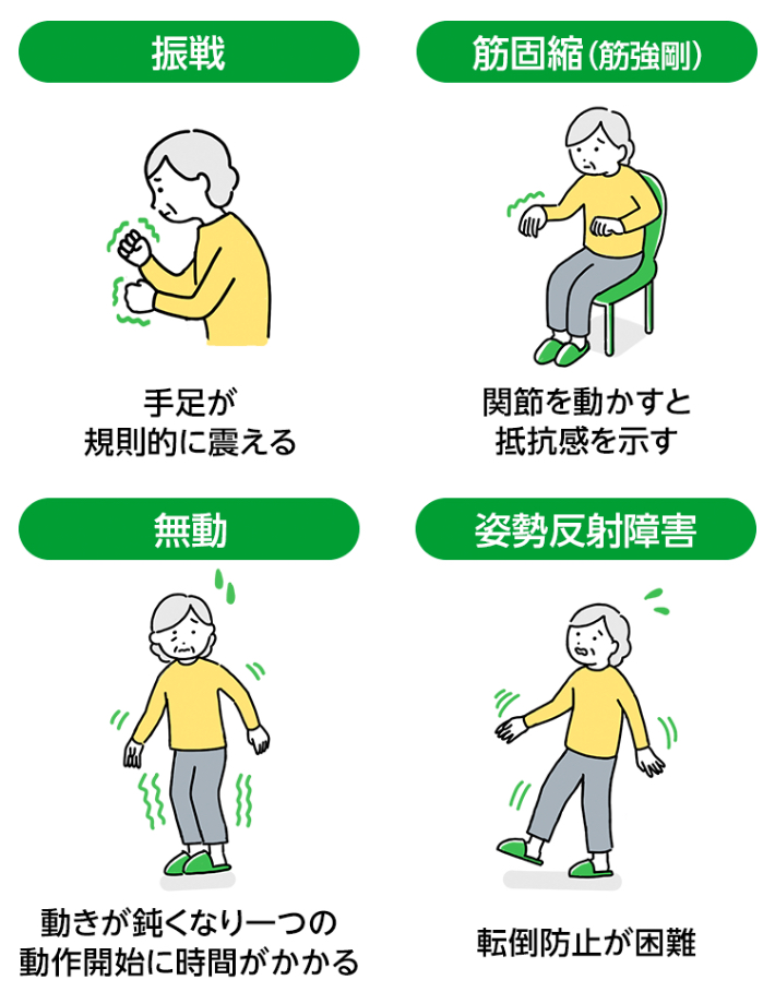 パーキンソン病 | 疾病別 環境整備 | 介護用品・設備 | パナソニックの
