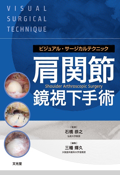 肩関節鏡視下手術【電子版】 | 医書.jp