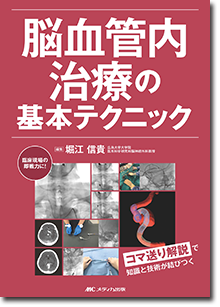 脳血管内治療の基本テクニック | オンラインストア｜看護・医学新刊