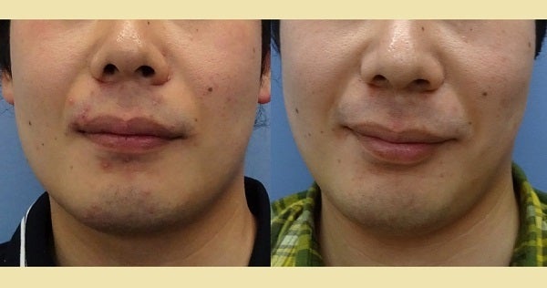 仙台の美容整形外科ならCLASSY仙台美容外科・美容皮膚科®