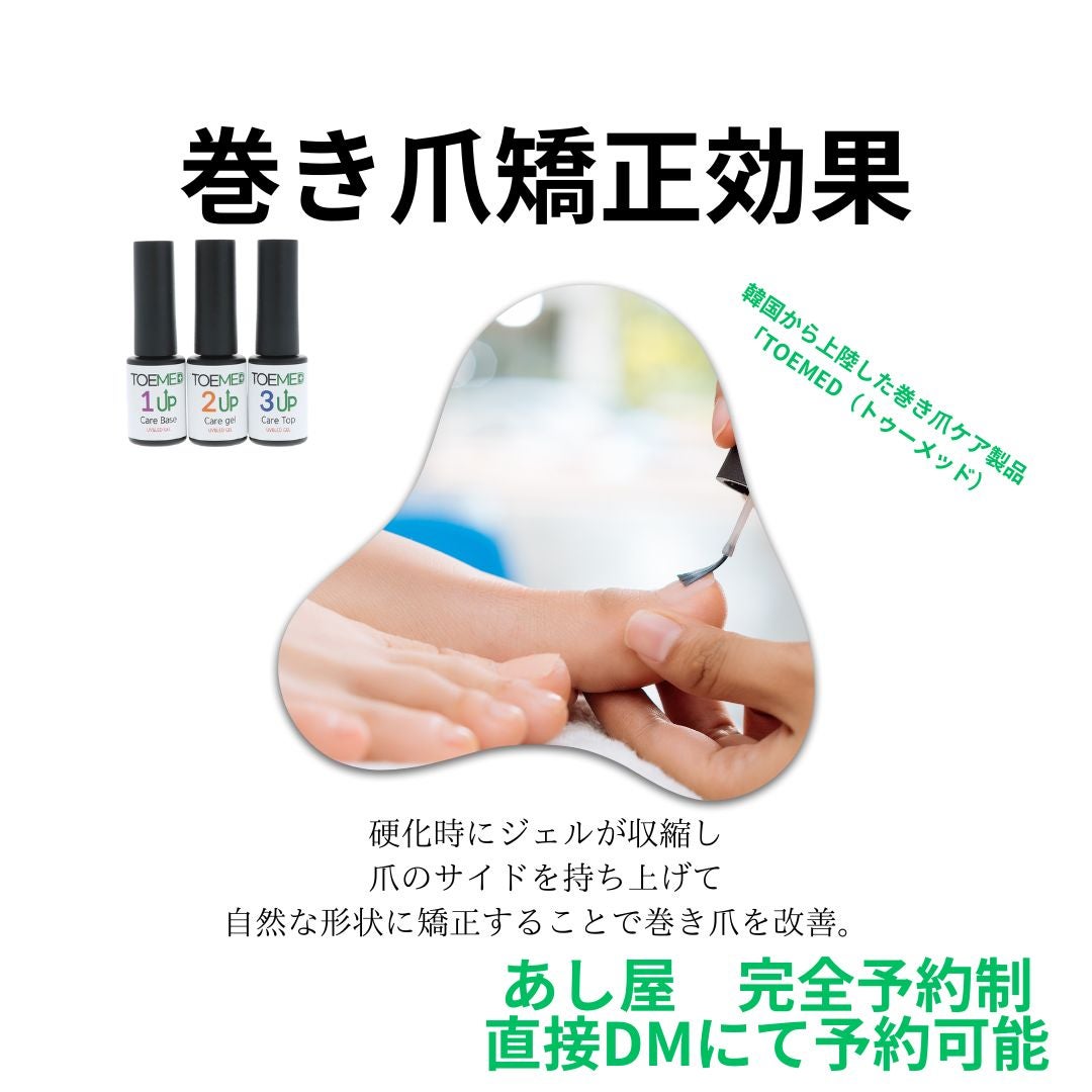 韓国発の革新的巻き爪ケアジェル「TOEMED」登場！美しい足元へ導く