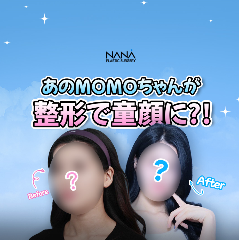 韓国整形/韓国美容】人気インフルエンサーMOMOちゃんの顔脂肪移植