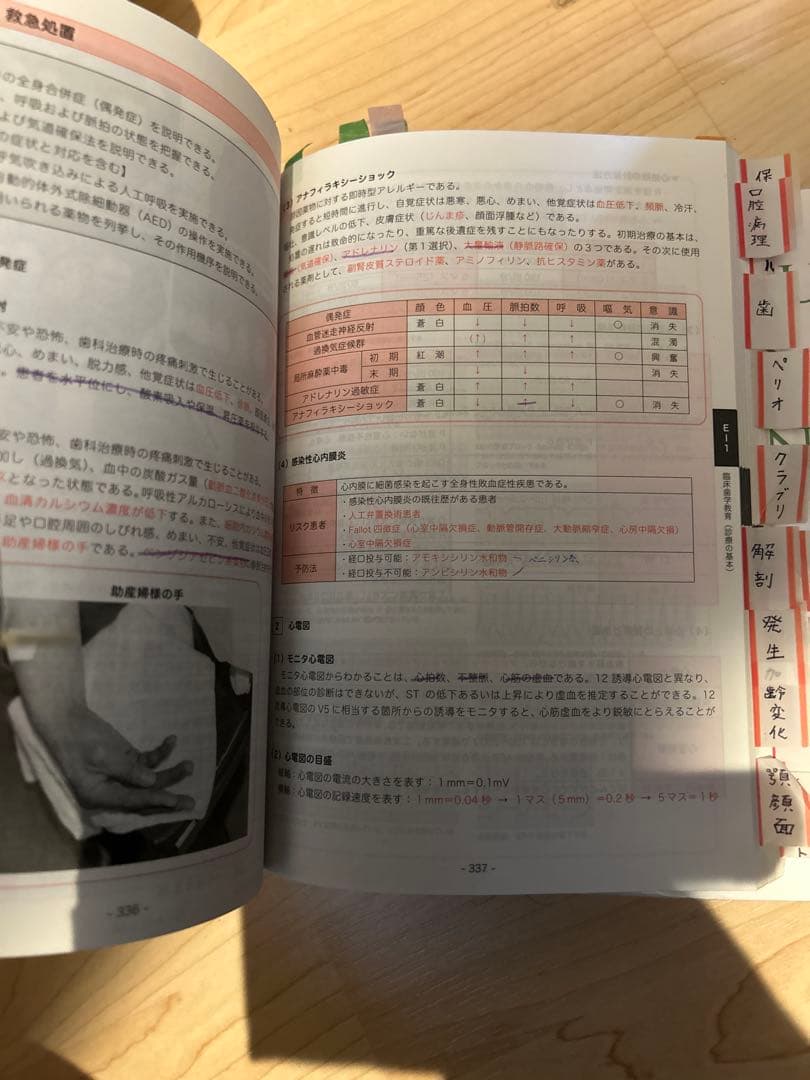 あ　CBT辞典　　Ｊ