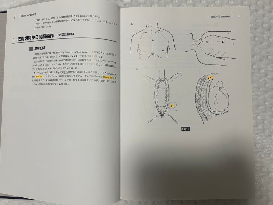 心臓血管外科手術書 磯村 - メルカリ