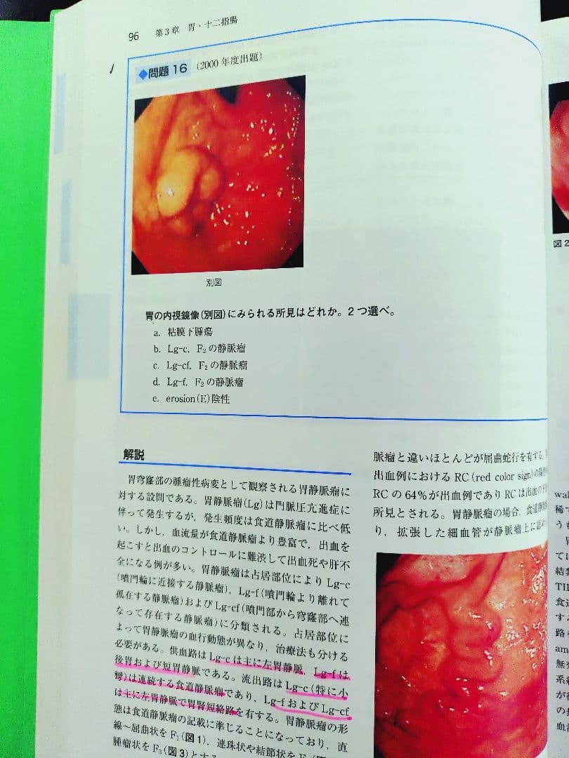 日本消化器内視鏡学会 専門医 学術試験問題〈解答と解説〉第5