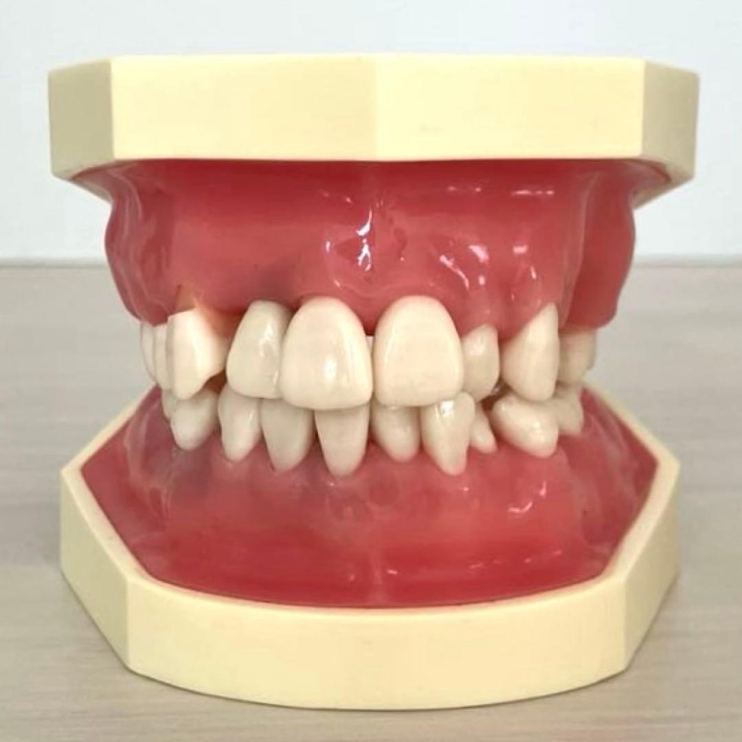 NISSIN ニッシン額模型 叢生顎模型 - メルカリ