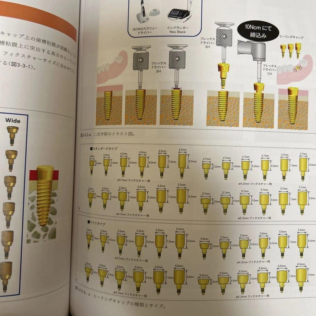 【希少】POI-EX SYSTEMの臨床 2006年版
