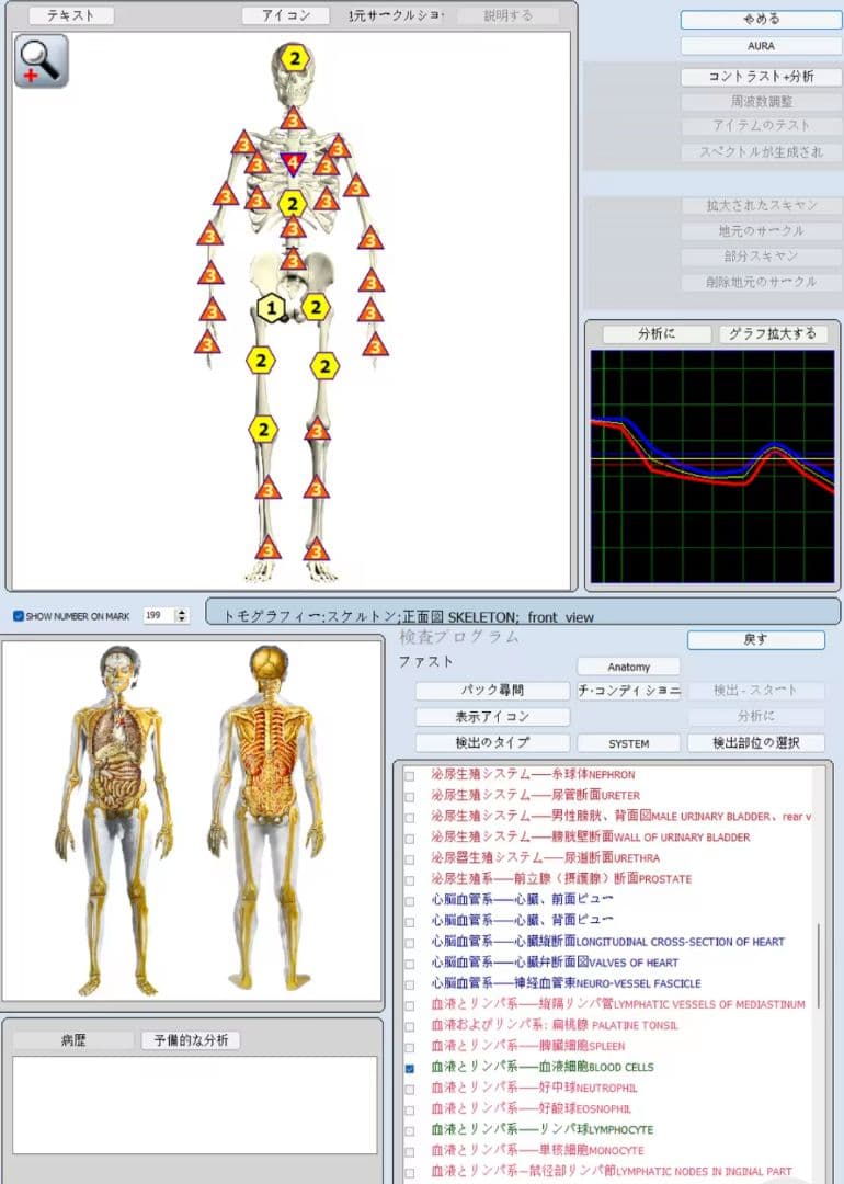 期間限定セール☆波動測定器18D NLS メタトロン ニュースキャン