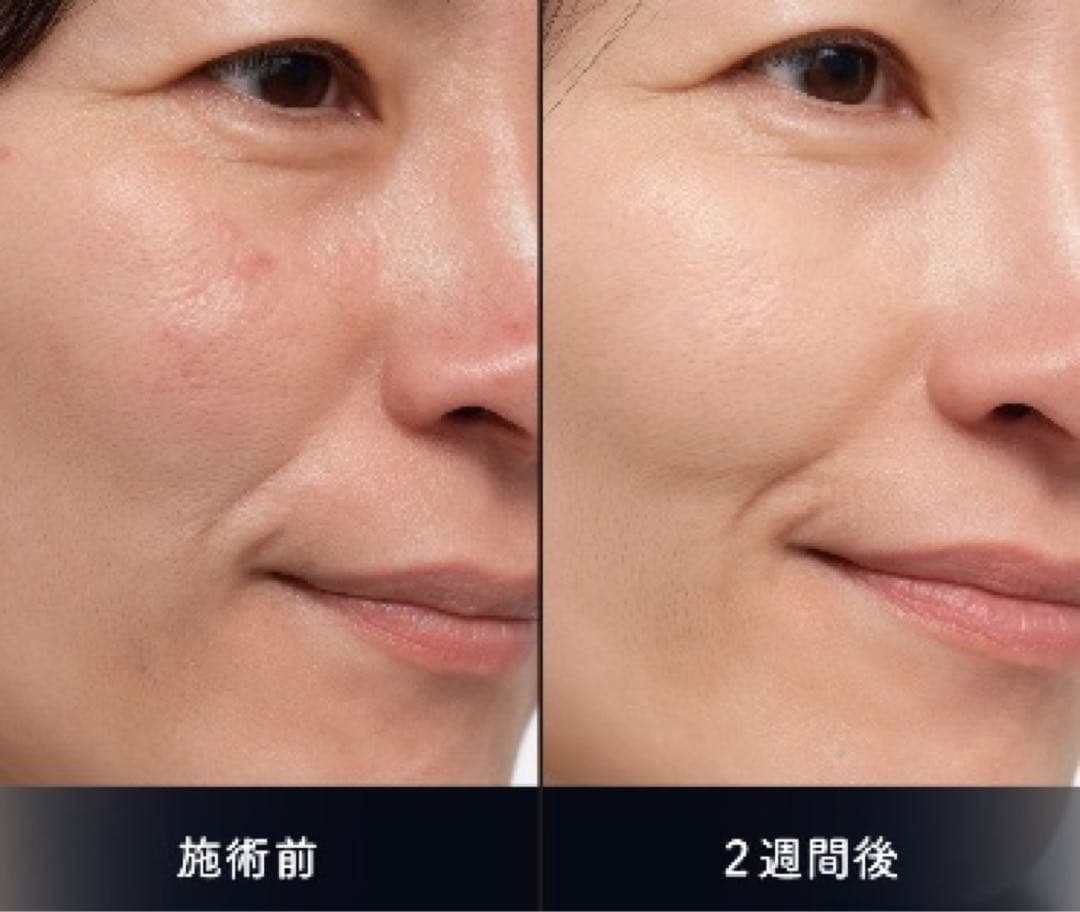 専用出品 もえか様