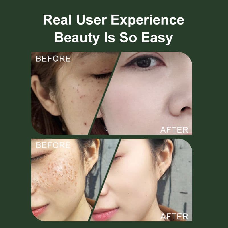 ✨️最安値VLVEE スキンケア機器 ホワイト顔シミ取り✨️ - メルカリ