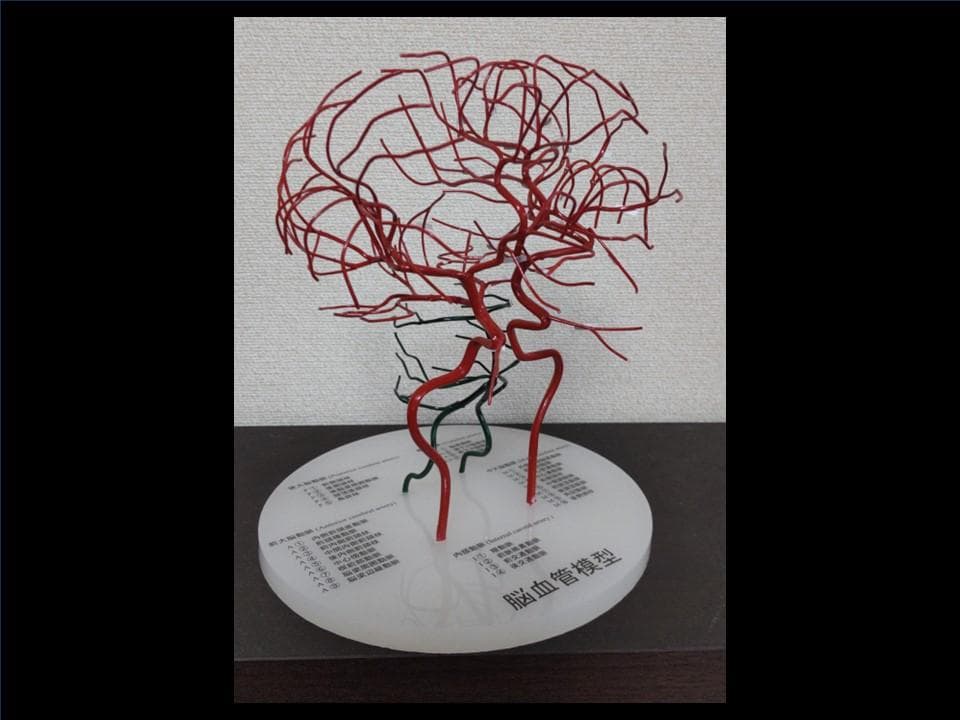 脳血管模型（内頸動脈、椎骨動脈） - メルカリ