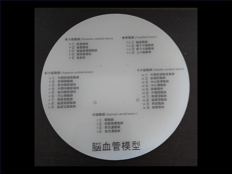脳血管模型（内頸動脈、椎骨動脈） - メルカリ