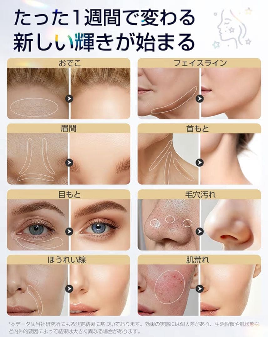 新品・未使用】美顔器 高周波 EMS 1台18役 光エステ リフトケア - メルカリ