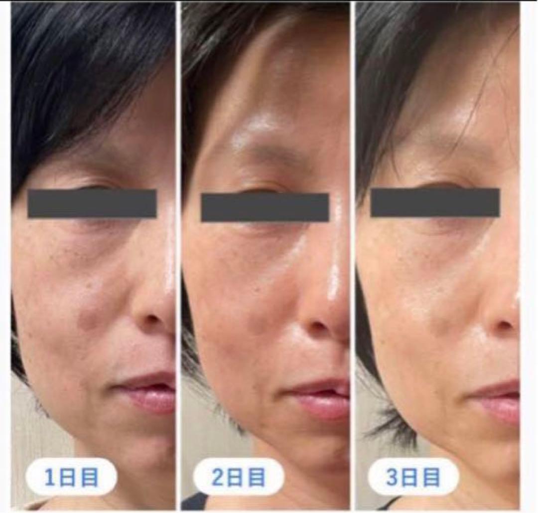 ハーブピーリング剥離なし 10回分(10g)業務用 - メルカリ