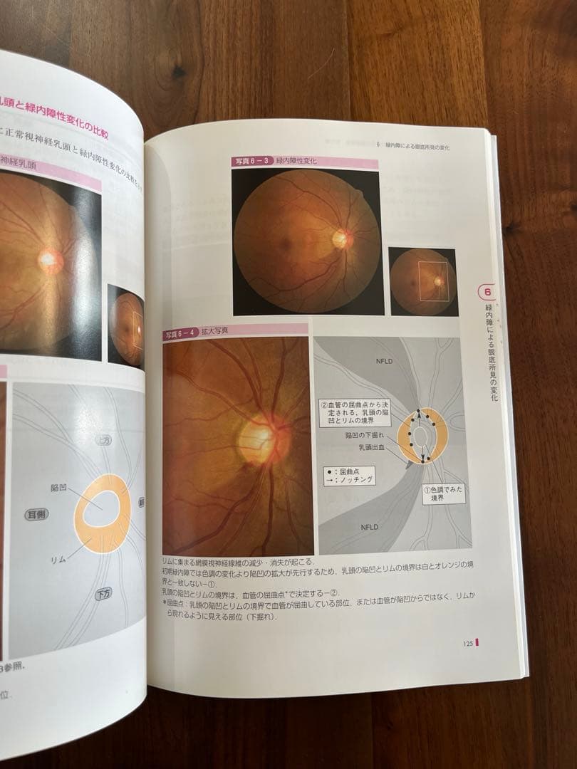 手にとるようにわかる健診のための眼底検査 改訂版 無散瞳カメラによる