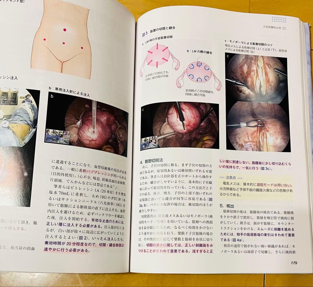 産婦人科手術スタンダード 改訂第２版 日本産婦人科手術学会編