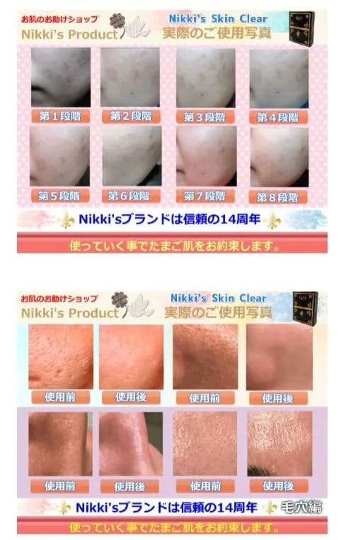 ニッキーズスキンクリア Nikki's Skin Clear通常用 - メルカリ