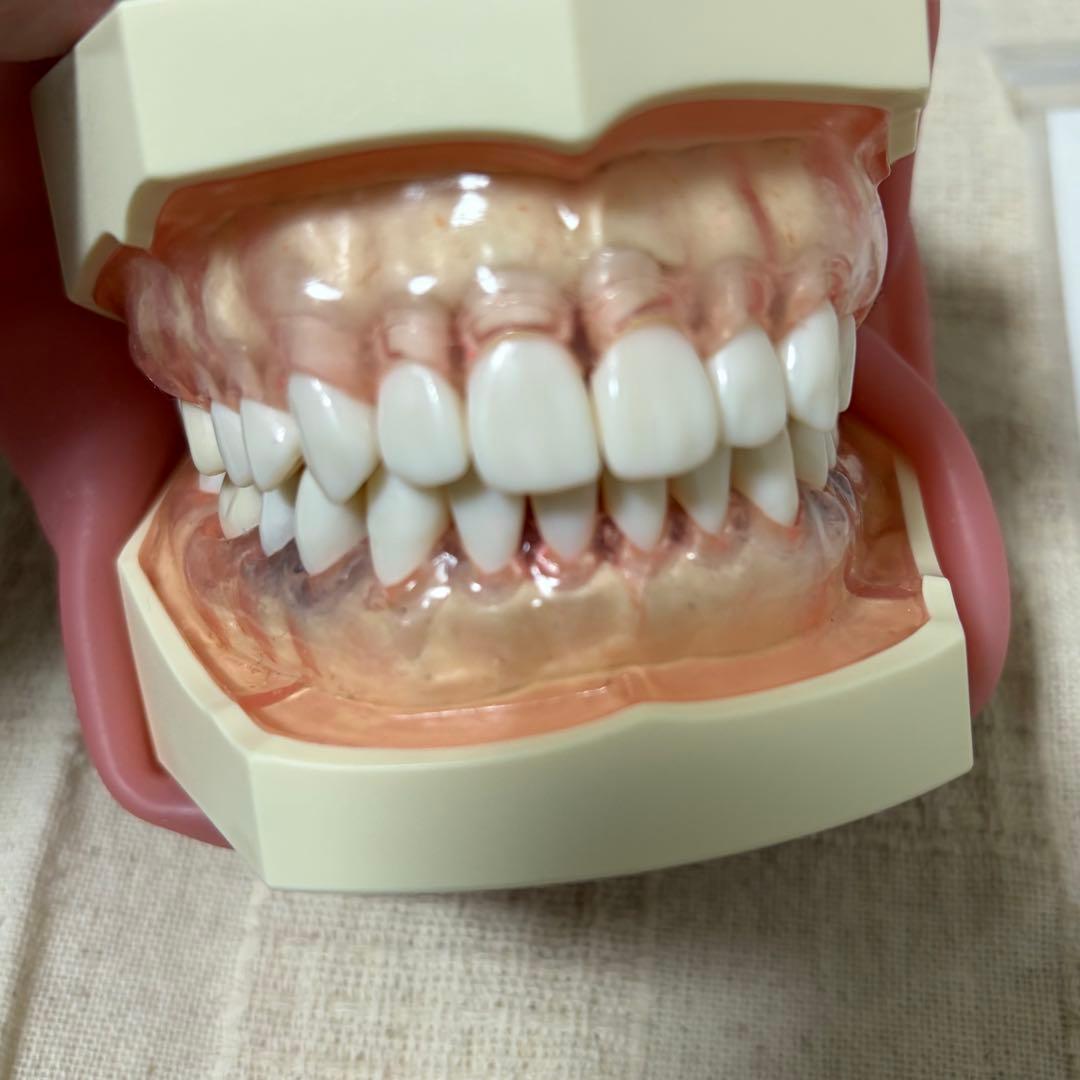 顎模型 頬粘膜付き 箱無し