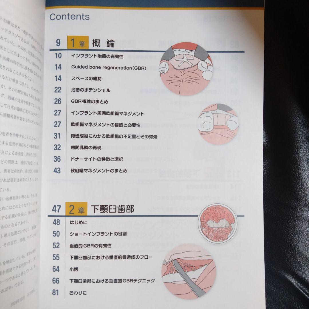 硬・軟組織マネジメント大全 インプラント 歯科 クインテッセンス出版