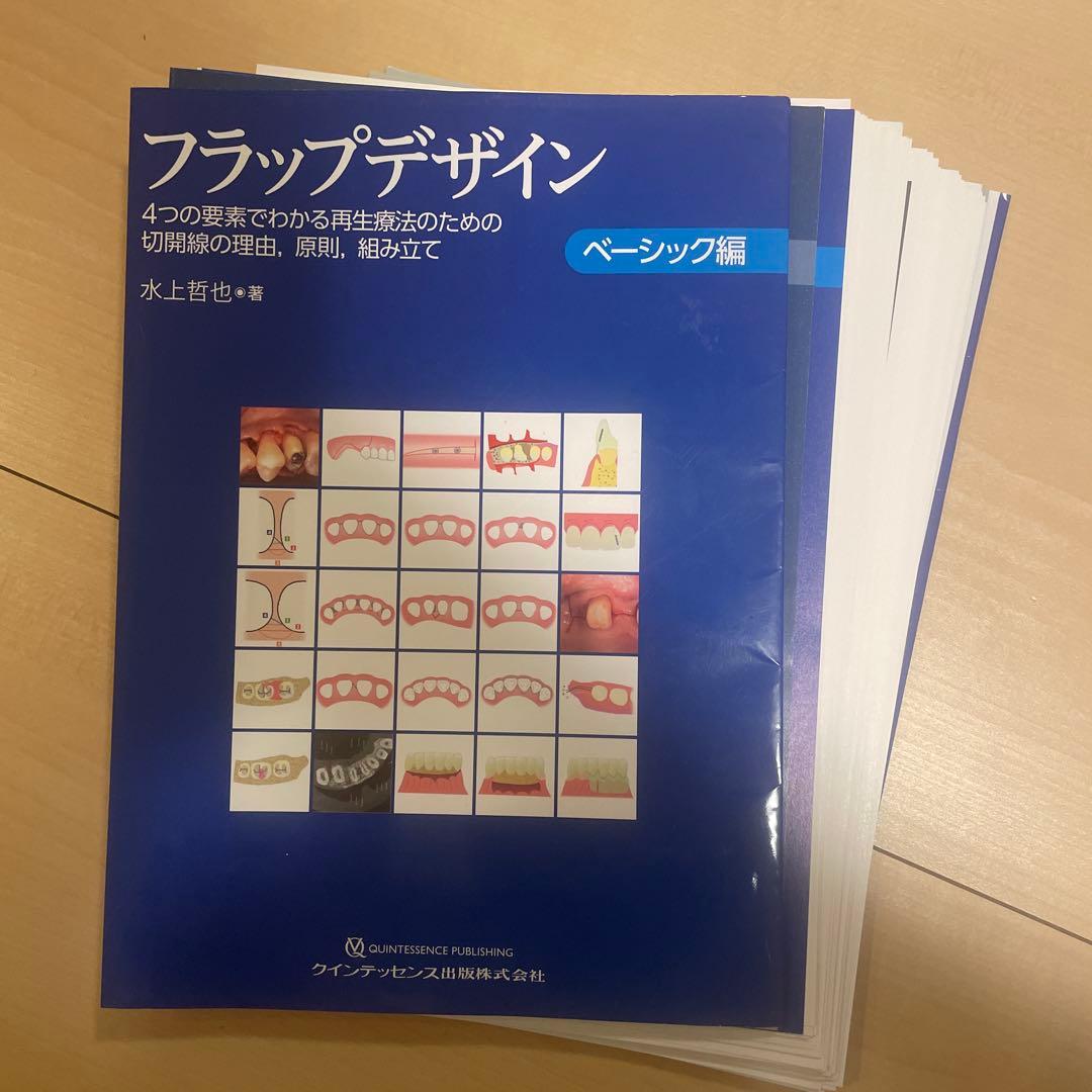裁断済み フラップデザイン : 4つの要素でわかる再生療法のための切開線