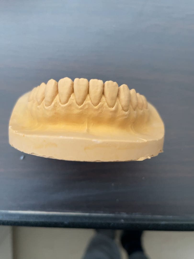 歯科技工 ワセトレ難波氏のサンプル模型です！