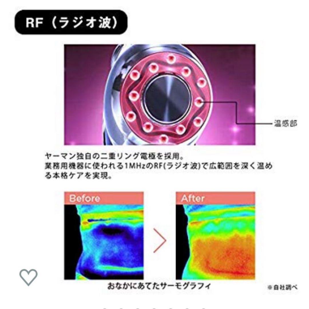 ダイエット　キャビテーション