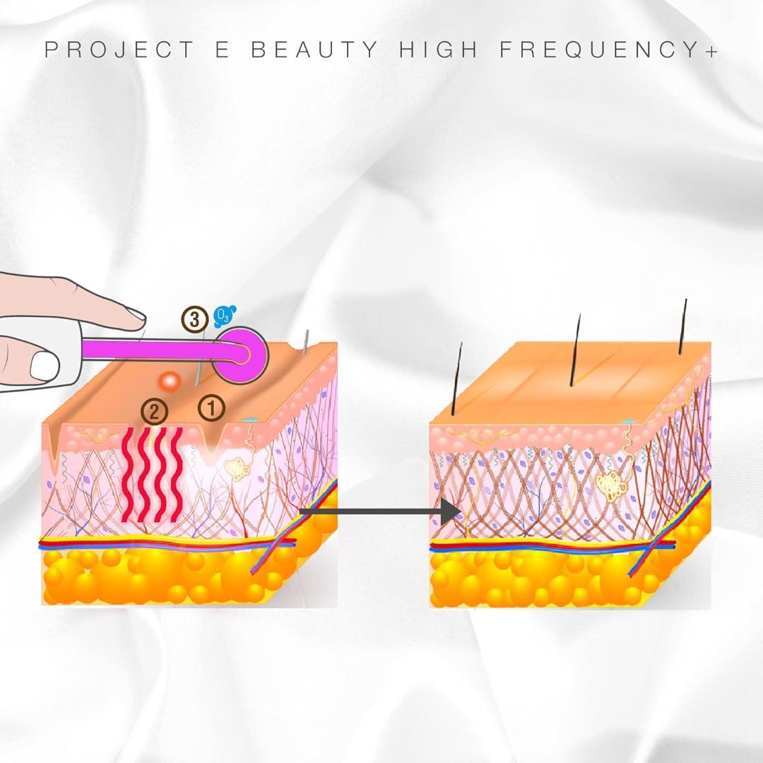 バイオレットレイ エドガーケイシー療法 高周波スキンケアデバイス