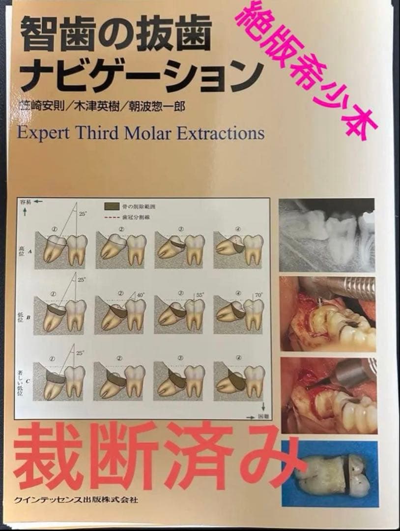 智歯の抜歯ナビゲーション 智歯の抜歯ナビゲーション - クインテッセンス出版
