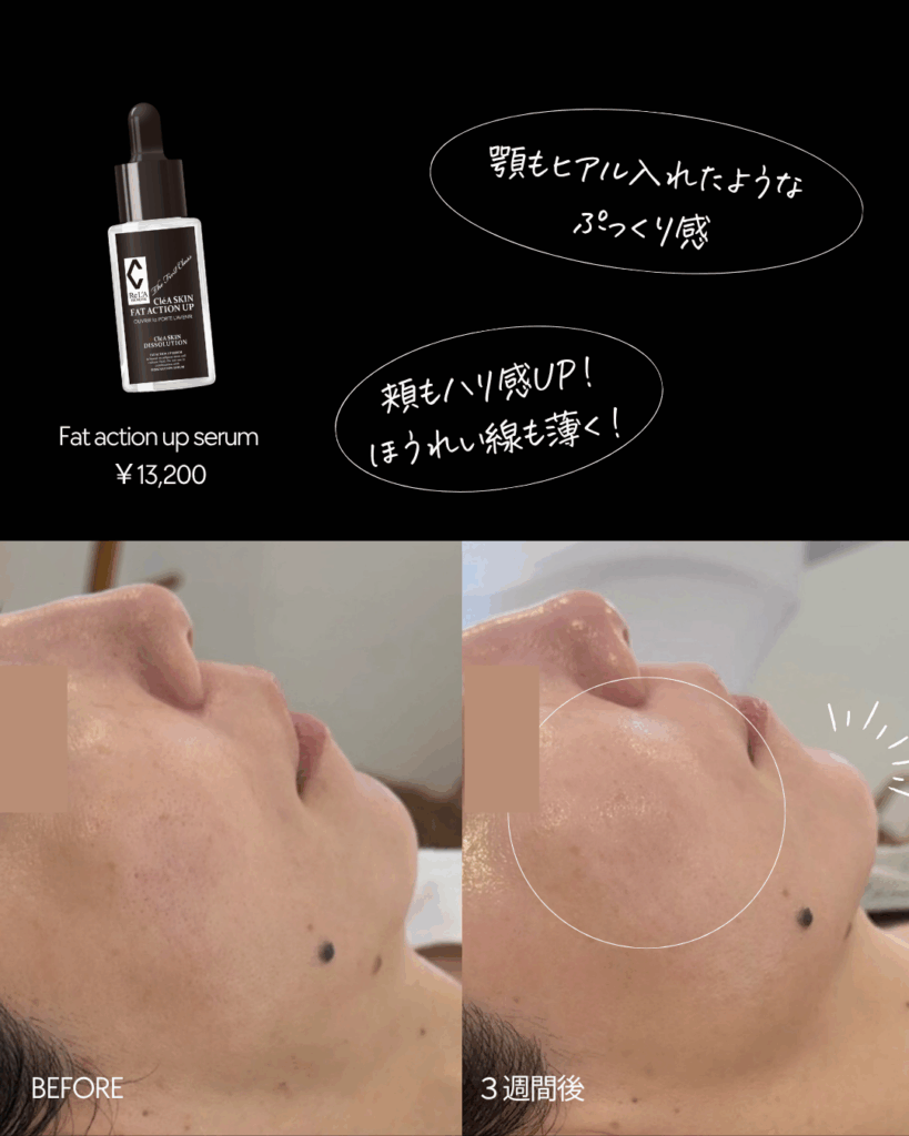 ふっくらハリ肌へ！クレアスキン ファットアクションアップ美容液