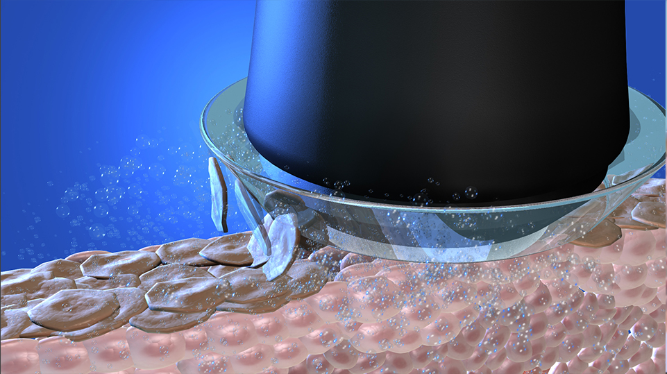 オキシジェネオ